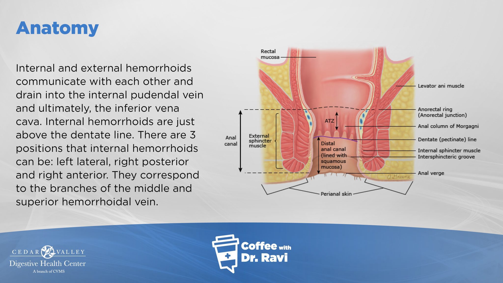 Inside Piles Coffee with Ravi #83: Anatomy and Classification of Hemorrhoids - Cedar ...